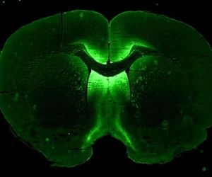 ارسال سلول‌های بنیادی به ایستگاه فضایی بین‌المللی برای شبیه‌سازی مغز انسان