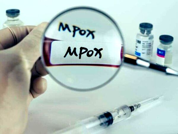 پاکستان چند فرودگاه را به دلیل شیوع ام‌پاکس ضدعفونی کرد